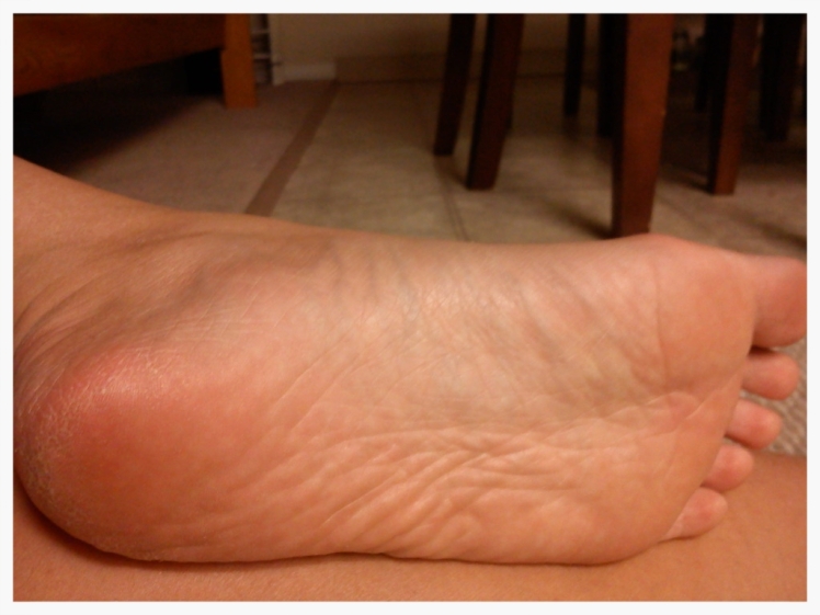 dry-feet-pictures-1